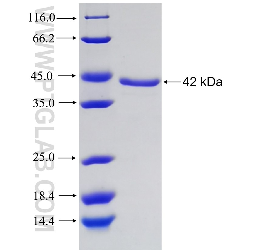 GPC1 Fusion Protein Ag10068 | Proteintech