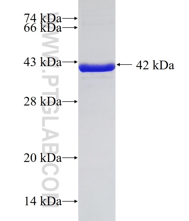 GPC1 Fusion Protein Ag10068 | Proteintech