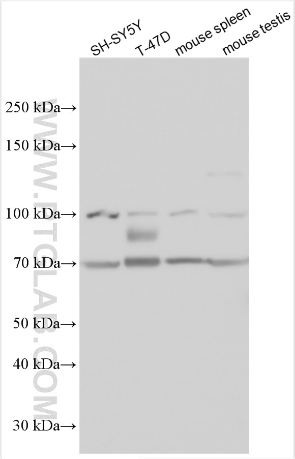 Western Blot (WB) analysis of various lysates using Glypican 2 Polyclonal antibody (13521-1-AP)
