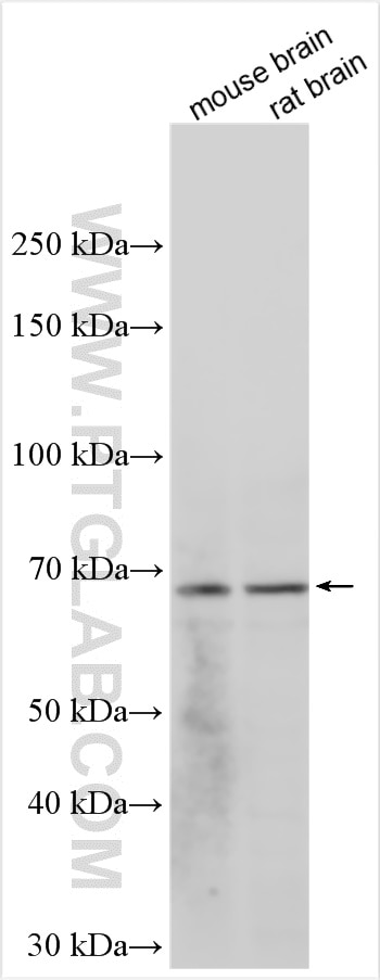 Western Blot (WB) analysis of various lysates using GPC2 Polyclonal antibody (27594-1-AP)
