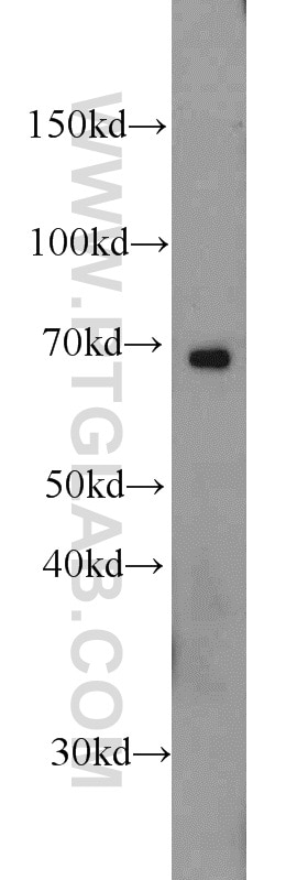 Glypican 3 Polyclonal antibody