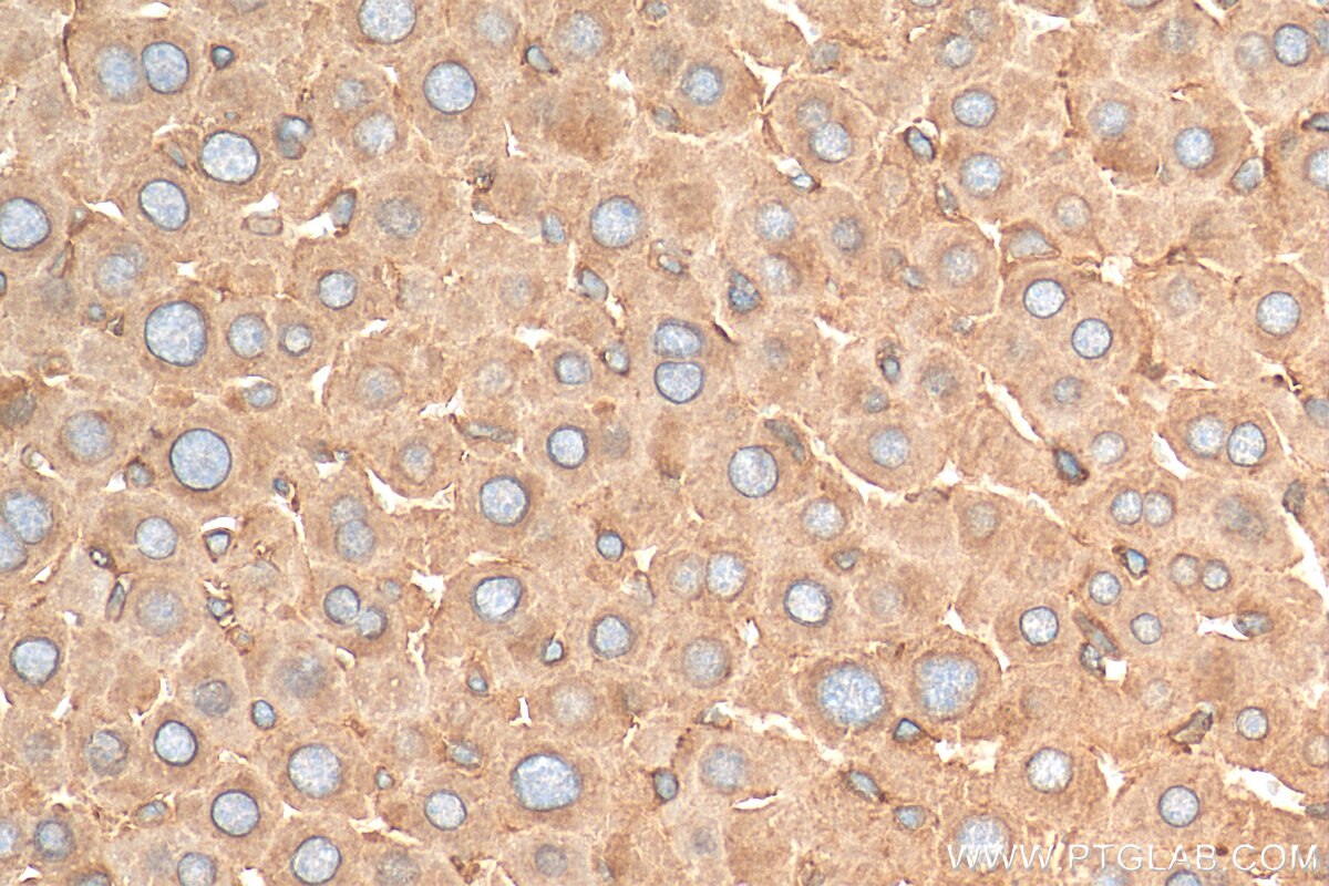 Immunohistochemistry (IHC) staining of mouse liver tissue using GPC3 Polyclonal antibody (30021-1-AP)