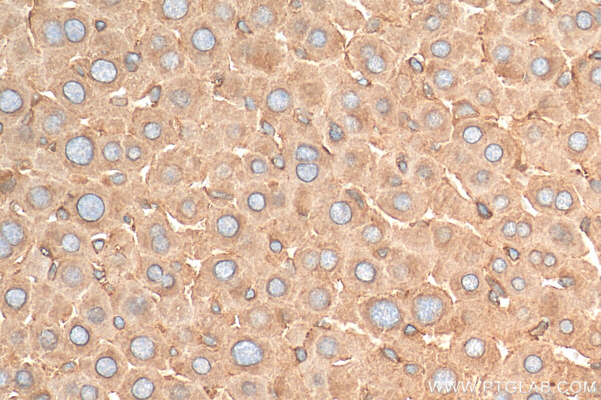 IHC staining of mouse liver using 30021-1-AP