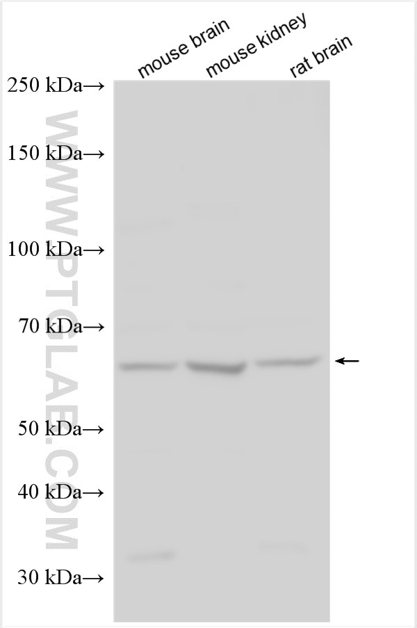 Western Blot (WB) analysis of various lysates using Glypican 4 Polyclonal antibody (13048-1-AP)
