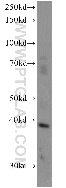 Western Blot (WB) analysis of human brain tissue using Glypican 4 Polyclonal antibody (13048-1-AP)