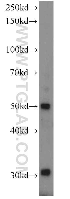 Western Blot (WB) analysis of mouse kidney tissue using Glypican 4 Polyclonal antibody (13048-1-AP)