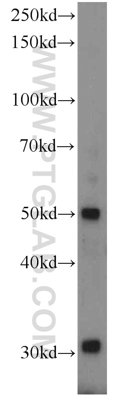 WB analysis of mouse kidney using 13048-1-AP