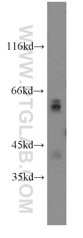 Western Blot (WB) analysis of A549 cells using Glypican 4 Polyclonal antibody (13048-1-AP)