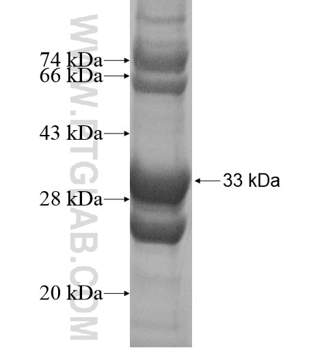 GPC6 fusion protein Ag16135 SDS-PAGE
