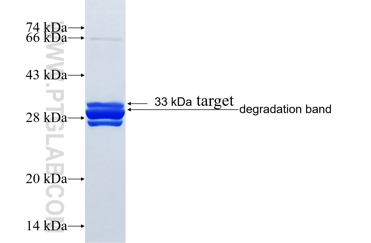 GPC6 fusion protein Ag16135 SDS-PAGE