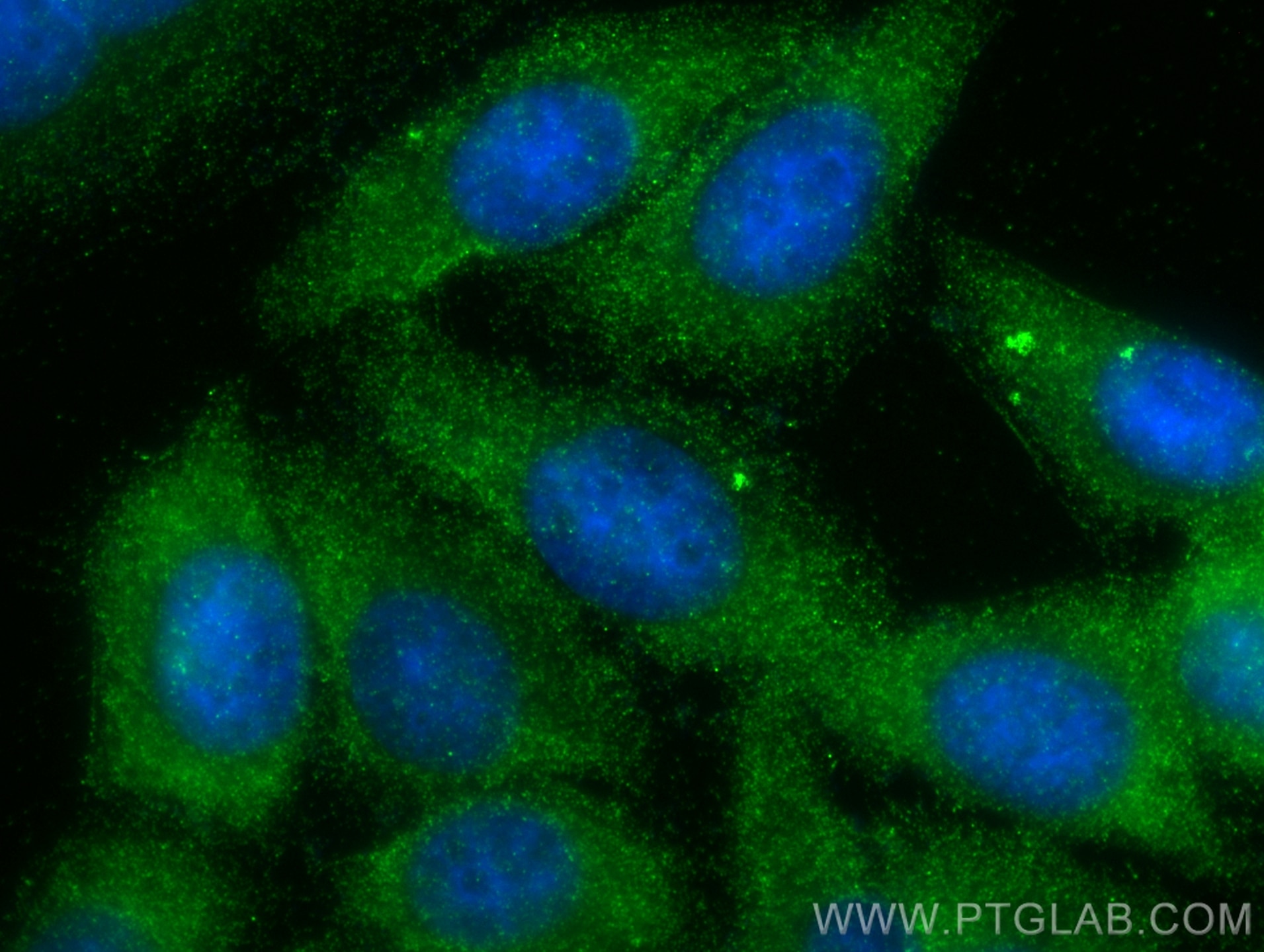 Immunofluorescence (IF) / fluorescent staining of HepG2 cells using GPD1 Polyclonal antibody (13451-1-AP)
