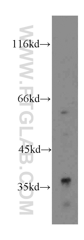 Western Blot (WB) analysis of HepG2 cells using GPD1 Polyclonal antibody (13451-1-AP)