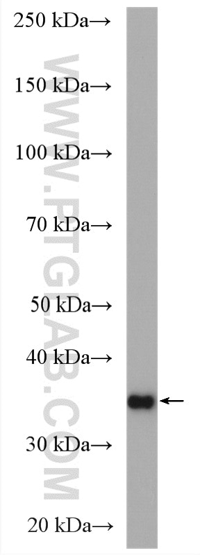 WB analysis of mouse liver using 27943-1-AP