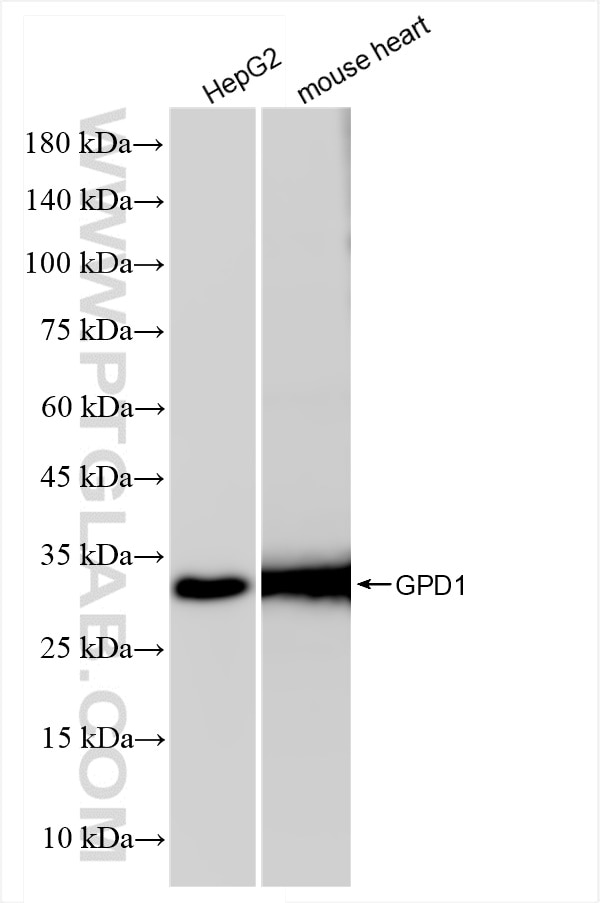 Western Blot (WB) analysis of various lysates using GPD1 Recombinant antibody (84800-4-RR)