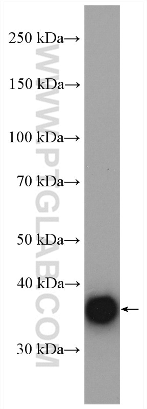 Western Blot (WB) analysis of mouse heart tissue using GPD1L Polyclonal antibody (17263-1-AP)