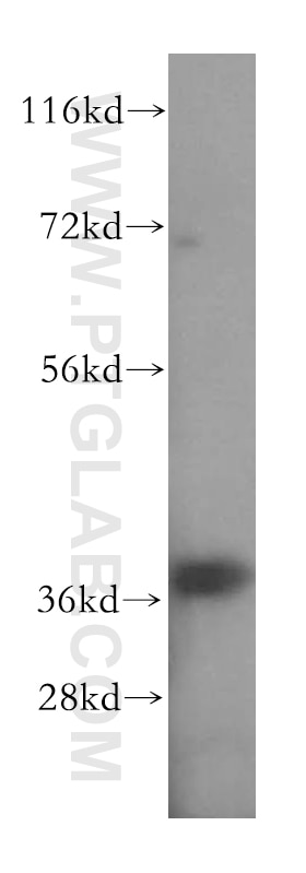 Western Blot (WB) analysis of human skeletal muscle tissue using GPD1L Polyclonal antibody (17263-1-AP)