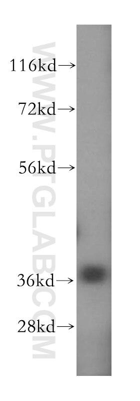 Western Blot (WB) analysis of human brain tissue using GPD1L Polyclonal antibody (17263-1-AP)