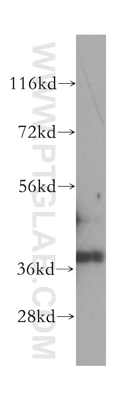 Western Blot (WB) analysis of HEK-293 cells using GPD1L Polyclonal antibody (17263-1-AP)