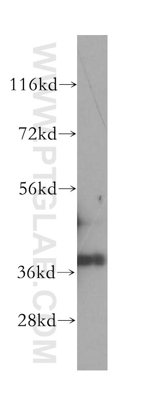 WB analysis of HEK-293 using 17263-1-AP