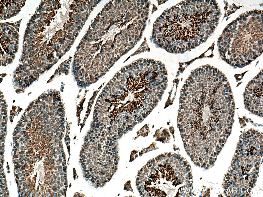 Immunohistochemistry (IHC) staining of mouse testis tissue using GPD2 Polyclonal antibody (17219-1-AP)