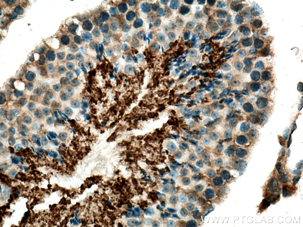 Immunohistochemistry (IHC) staining of mouse testis tissue using GPD2 Polyclonal antibody (17219-1-AP)