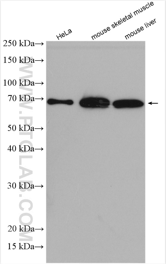 Western Blot (WB) analysis of various lysates using GPD2 Polyclonal antibody (17219-1-AP)