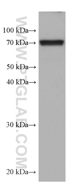 Western Blot (WB) analysis of HSC-T6 cells using GPD2 Monoclonal antibody (68174-1-Ig)