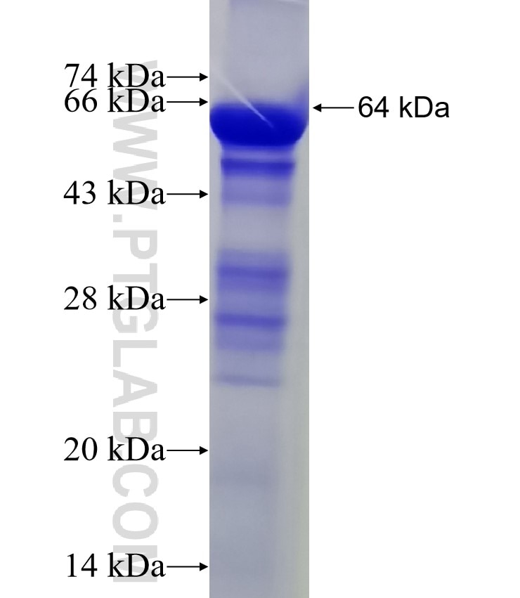 GPD2 fusion protein Ag11036 SDS-PAGE