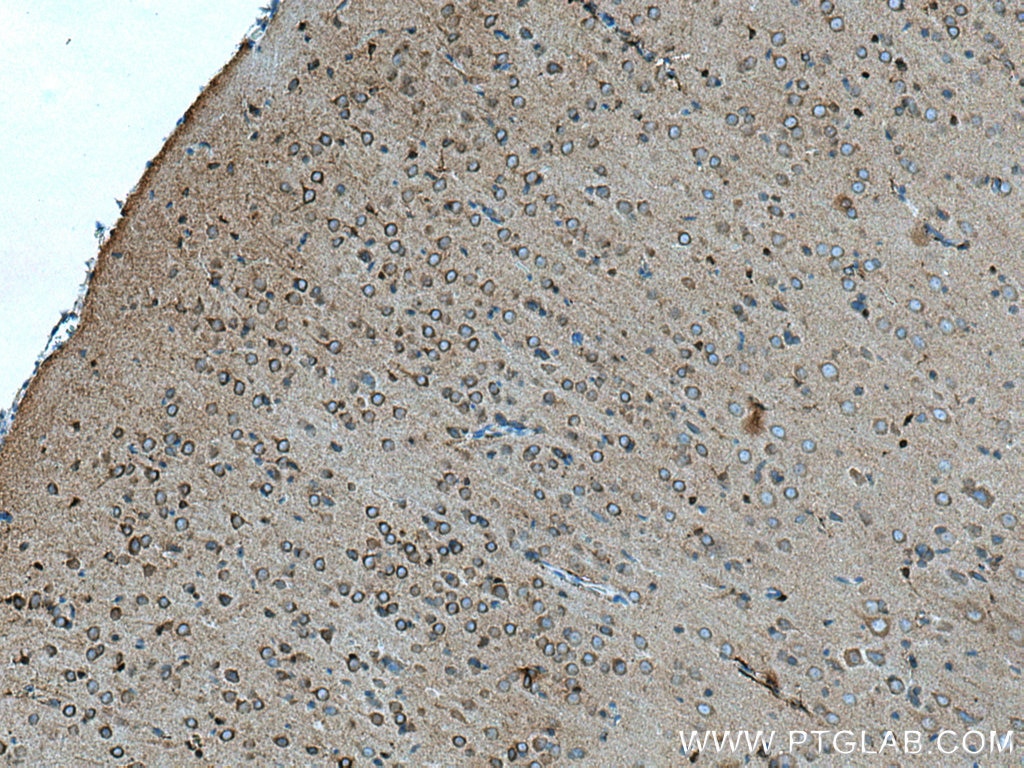 Immunohistochemistry (IHC) staining of rat brain tissue using gephyrin Polyclonal antibody (12681-1-AP)
