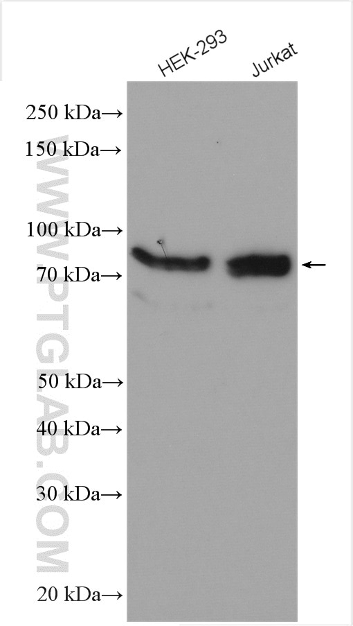 Western Blot (WB) analysis of various lysates using gephyrin Polyclonal antibody (12681-1-AP)