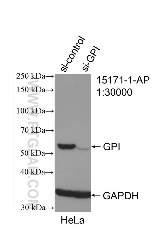 Western Blot (WB) analysis of HeLa cells using GPI Polyclonal antibody (15171-1-AP)
