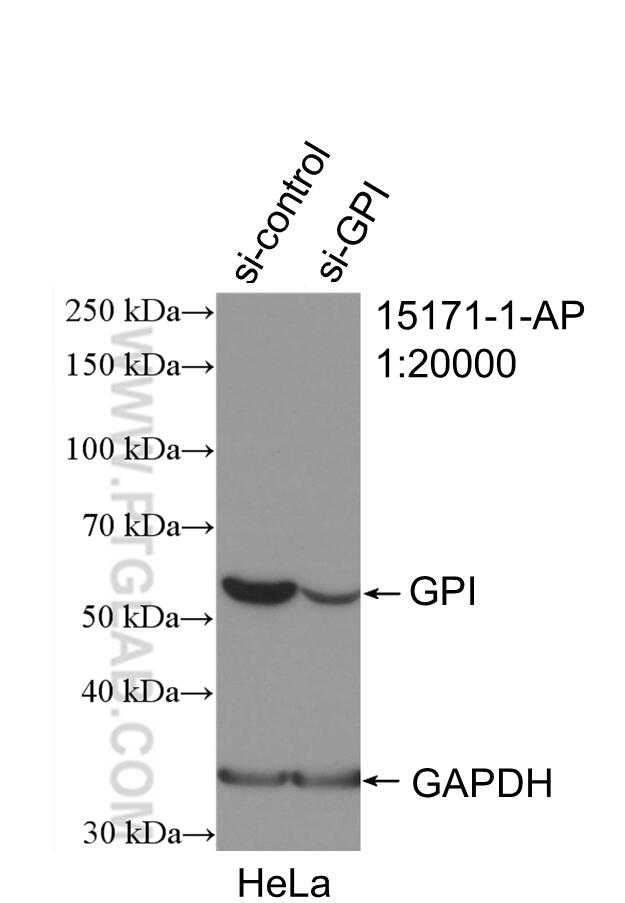 Western Blot (WB) analysis of HeLa cells using GPI Polyclonal antibody (15171-1-AP)