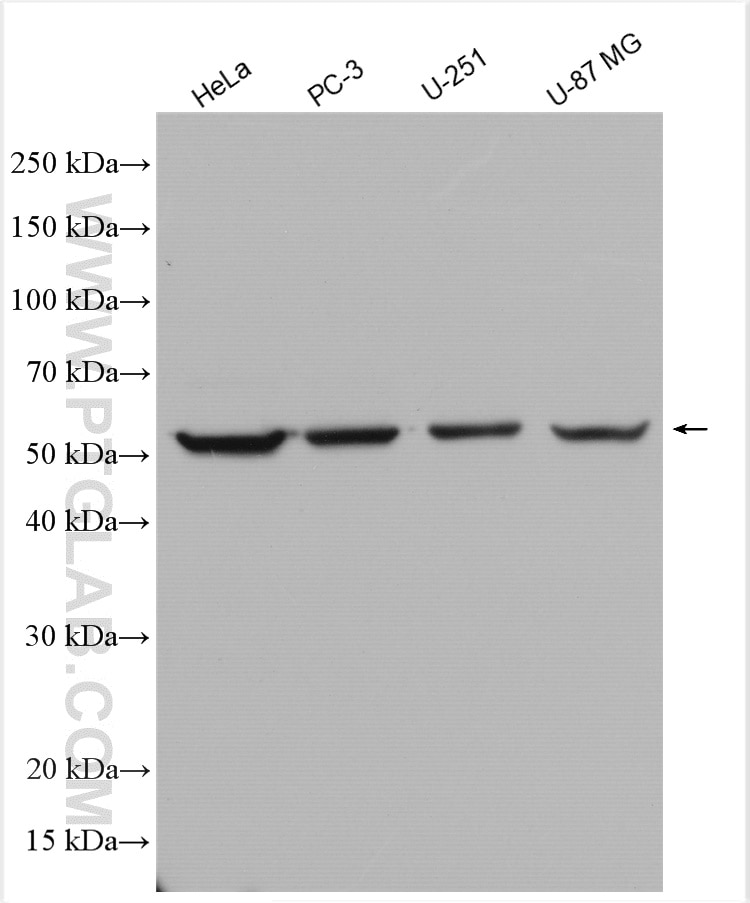 Western Blot (WB) analysis of various lysates using GPI Polyclonal antibody (15171-1-AP)