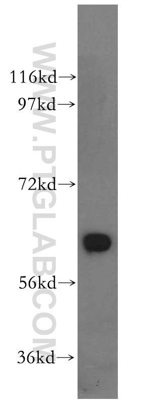 Western Blot (WB) analysis of PC-3 cells using GPI Polyclonal antibody (15171-1-AP)