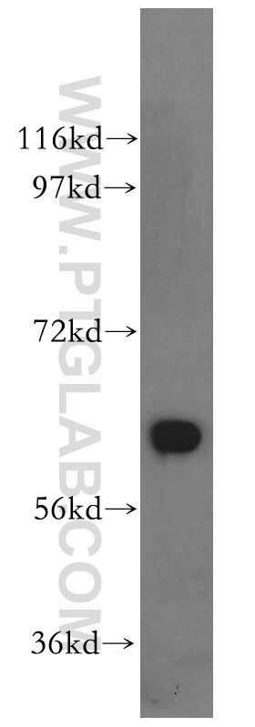 WB analysis of PC-3 using 15171-1-AP