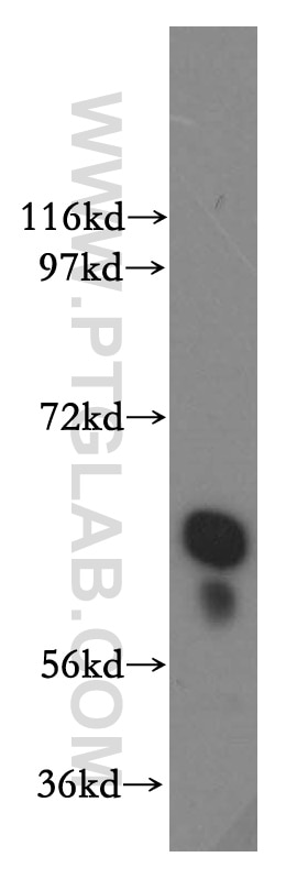 WB analysis of HeLa using 15171-1-AP