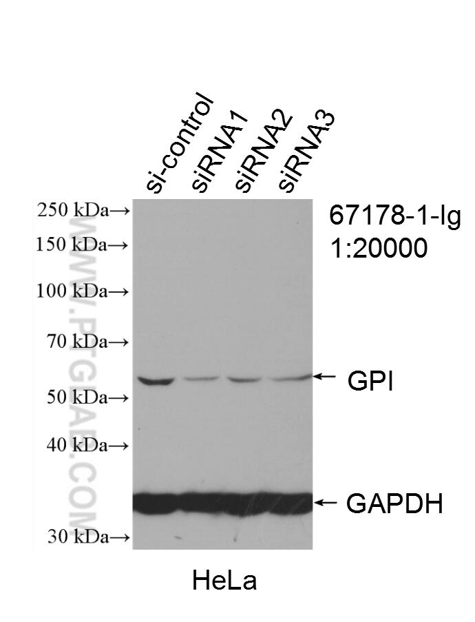 Western Blot (WB) analysis of HeLa cells using GPI Monoclonal antibody (67178-1-Ig)