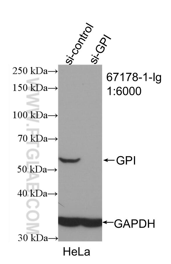 Western Blot (WB) analysis of HeLa cells using GPI Monoclonal antibody (67178-1-Ig)