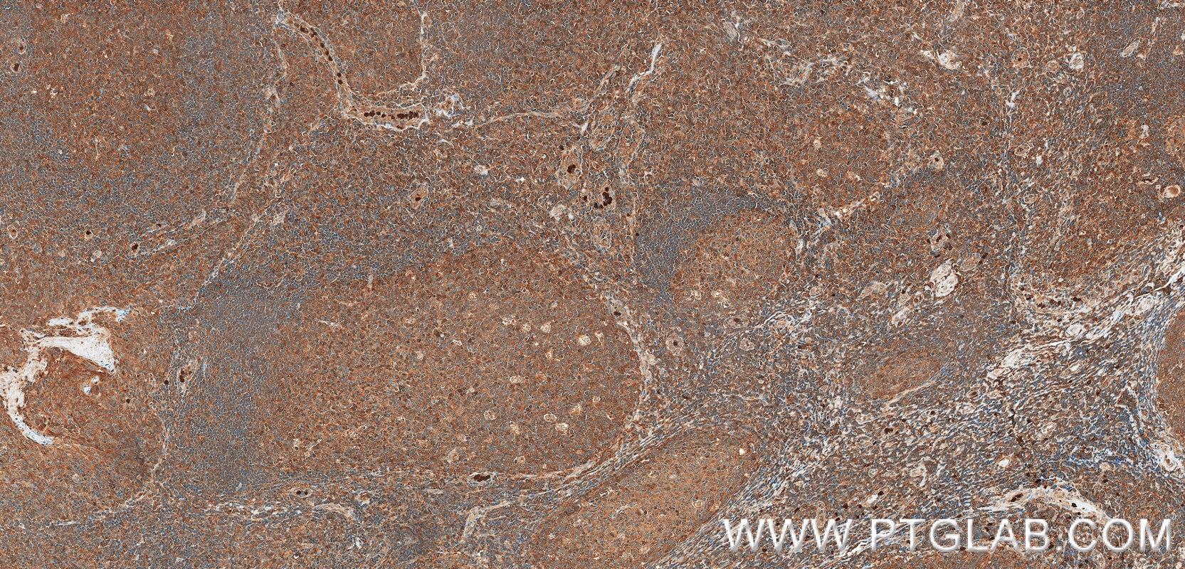 IHC staining of human tonsil using 98942-1-RR (same clone as 98942-1-PBS) Immunohistochemistry (IHC) staining of human tonsil tissue using Anti-Human GPI Rabbit Recombinant Antibody (98942-1-RR)
