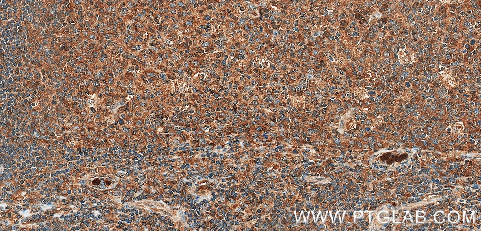 IHC staining of human tonsil using 98942-1-RR (same clone as 98942-1-PBS) Immunohistochemistry (IHC) staining of human tonsil tissue using Anti-Human GPI Rabbit Recombinant Antibody (98942-1-RR)