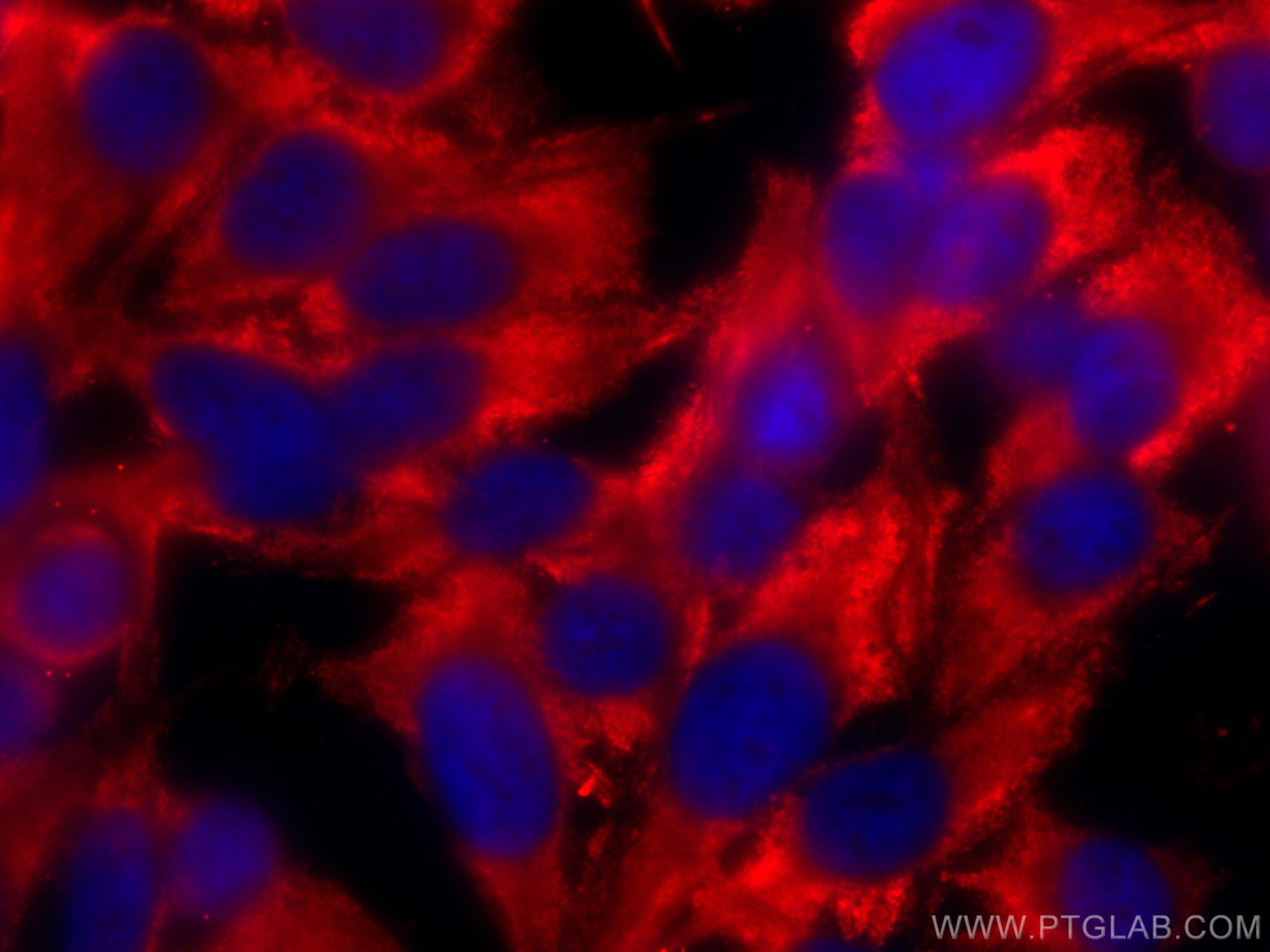 Immunofluorescence (IF) / fluorescent staining of PC-3 cells using CoraLite® Plus 594-conjugated GPI Monoclonal antib (CL594-67178)