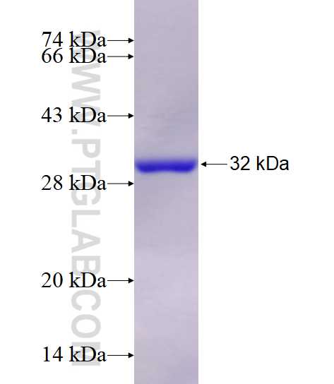 GPI fusion protein Ag7419 SDS-PAGE