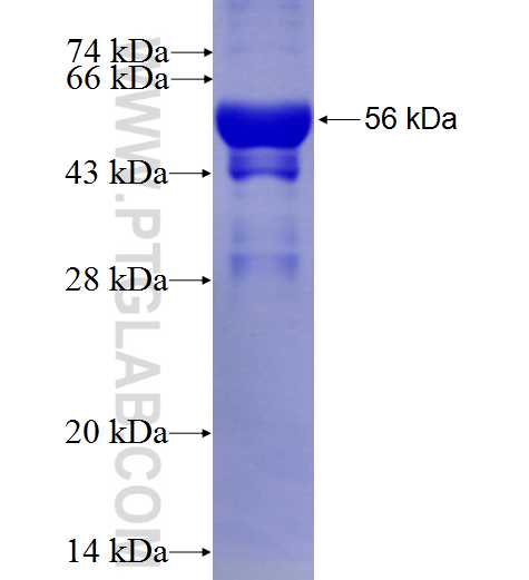 GPI fusion protein Ag7423 SDS-PAGE