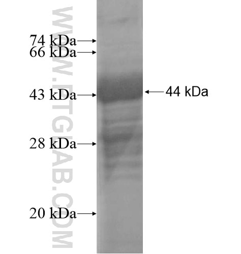 GPIHBP1 fusion protein Ag15565 SDS-PAGE