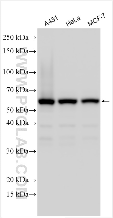 Western Blot (WB) analysis of various lysates using GPKOW Polyclonal antibody (14728-1-AP)