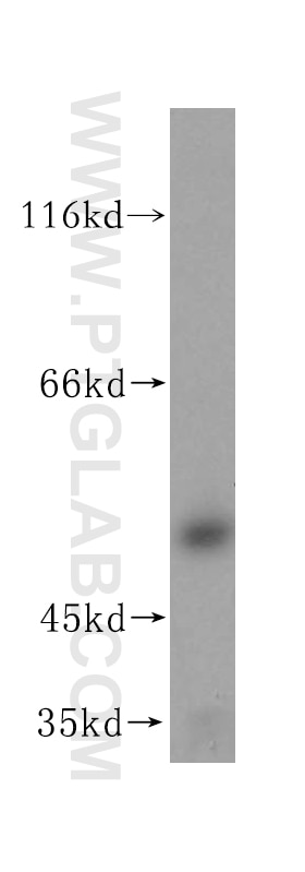 Western Blot (WB) analysis of human liver tissue using GPKOW Polyclonal antibody (14728-1-AP)