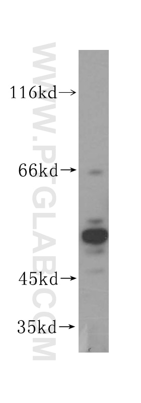 Western Blot (WB) analysis of HeLa cells using GPKOW Polyclonal antibody (14728-1-AP)