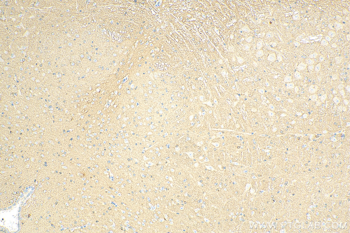 Immunohistochemistry (IHC) staining of mouse brain tissue using GPM6A Polyclonal antibody (15044-1-AP)