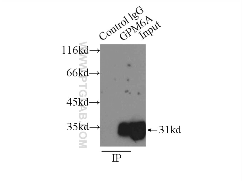 Immunoprecipitation (IP) experiment of mouse brain tissue using GPM6A Polyclonal antibody (15044-1-AP)