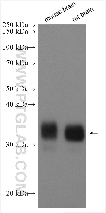 Western Blot (WB) analysis of various lysates using GPM6A Polyclonal antibody (15044-1-AP)